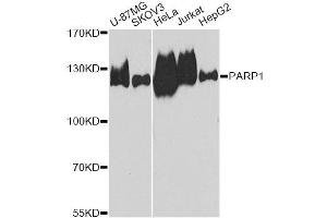 Western Blotting (WB) image for anti-Poly (ADP-Ribose) Polymerase 1 (PARP1) (AA 81-390) antibody (ABIN6145232)