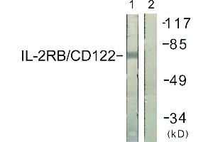 Immunohistochemistry analysis of paraffin-embedded human lung carcinoma tissue using IL-2Rβ/CD122 (Ab-364) antibody. (IL2 Receptor beta antibody)