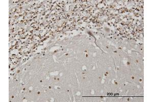 Immunoperoxidase of monoclonal antibody to IBRDC2 on formalin-fixed paraffin-embedded human cerebellum. (RNF144B antibody  (AA 1-100))