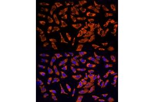 Immunofluorescence analysis of U2OS cells using EPS15 Rabbit pAb  at dilution of 1:200 (40x lens).