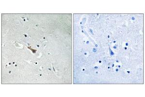 Immunohistochemistry analysis of paraffin-embedded human brain tissue using APLP2 (Phospho-Tyr755) antibody.