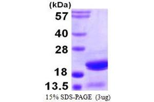 SDS-PAGE (SDS) image for Actin Related Protein 2/3 Complex, Subunit 5, 16kDa (ARPC5) (AA 1-151) protein (His tag) (ABIN667461)