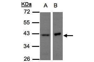 WB Image Sample(30 μg of whole cell lysate) A:H1299 B:Raji, 10% SDS PAGE antibody diluted at 1:500 (NDUFA10 antibody  (Center))