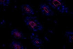 Immunofluorescence (fixed cells) (IF/ICC) image for anti-alpha-Actinin Skeletal Muscle (ACTN) antibody (ABIN7073023)
