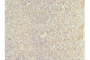 Immunohistochemistry of paraffin-embedded human tonsil tissue using ABIN7172948 at dilution of 1:100 (TM9SF3 antibody  (AA 133-300))