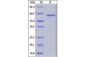 Human Tau-441, His Tag on  under reducing (R) condition. (tau-441 (AA 1-441) protein (His tag))