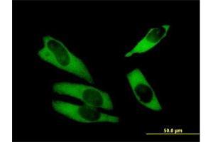 Immunofluorescence (IF) image for anti-ATP-Binding Cassette, Sub-Family F (GCN20), Member 1 (ABCF1) (AA 1-845) antibody (ABIN513036)