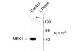 Image no. 1 for anti-Mitogen-Activated Protein Kinase Kinase 1 (MAP2K1) (pThr386) antibody (ABIN221148) (MEK1 antibody  (pThr386))