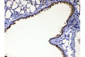 Immunohistochemistry (IHC) image for anti-WAP Four-Disulfide Core Domain 2 (WFDC2) (AA 31-168) antibody (ABIN5519074)