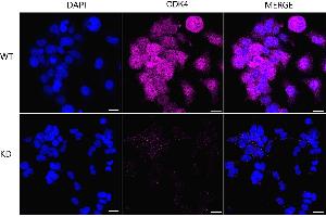 Immunocytochemical staining of HeLa cells using CDK4 antibody (ABIN7798214), 1:1,000), Top panel: wild-type (WT), Bottom panal: CDK4 shRNA knockdown (KD). (Recombinant CDK4 antibody)