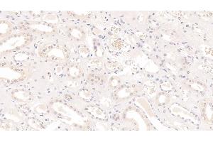 Detection of IL9 in Human Kidney Tissue using Monoclonal Antibody to Interleukin 9 (IL9) (IL-9 antibody  (AA 19-144))