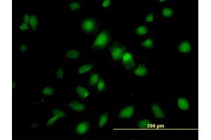 Immunofluorescence of purified MaxPab antibody to RBMS1 on HeLa cell. (RBMS1 antibody  (AA 1-406))
