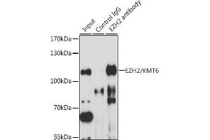 Immunoprecipitation analysis of 200 μg extracts of HT-29 cells, using 3 μg EZH2/KMT6 antibody (ABIN6133510, ABIN6140394, ABIN6140397 and ABIN6218016).