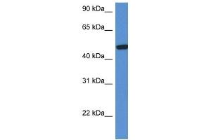 Western Blot showing HEXA antibody used at a concentration of 1 ug/ml against Fetal Kidney Lysate (Hexosaminidase A antibody  (C-Term))