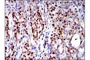 Immunohistochemistry (IHC) image for anti-Runt-Related Transcription Factor 3 (RUNX3) (AA 186-252) antibody (ABIN1846067)