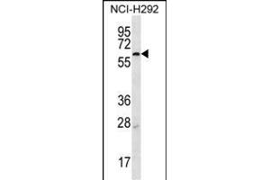 MBTPS2 anticorps  (N-Term)