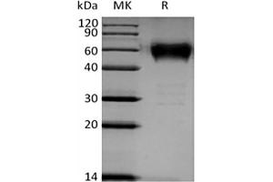 Western Blotting (WB) image for B and T Lymphocyte Associated (BTLA) protein (mFc Tag) (ABIN7319775) (BTLA Protein (mFc Tag))
