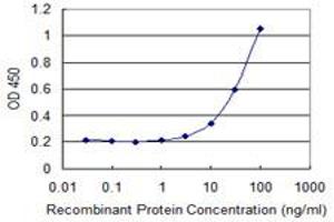 Detection limit for recombinant GST tagged GIT2 is 1 ng/ml as a capture antibody. (GIT2 antibody  (AA 1-471))