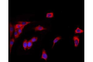 ABIN6260454 and ABIN6272856 staining HepG2 by IF/ICC. (Caprin-1 antibody  (Internal Region))
