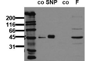 Western Blotting (WB) image for anti-Vasodilator-Stimulated phosphoprotein (VASP) (pSer239) antibody (ABIN126913) (VASP antibody  (pSer239))