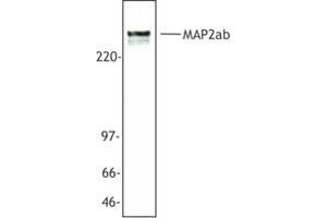 Image no. 1 for anti-Microtubule-Associated Protein 2 (MAP2) antibody (ABIN205408) (MAP2 antibody)
