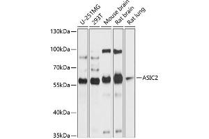 Western blot analysis of extracts of various cell lines, using  antibody (ABIN6129939, ABIN6137189, ABIN6137190 and ABIN6214773) at 1:1000 dilution. (ACCN1 antibody  (AA 120-400))