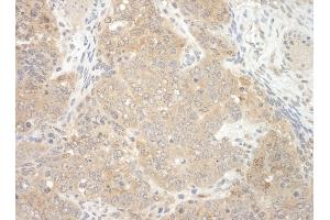 Immunohistochemistry (IHC) image for anti-E3 ubiquitin-protein ligase NEDD4-like (NEDD4L) (AA 275-325) antibody (ABIN7448685)