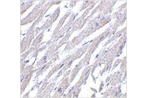 Immunohistochemistry of CRTH2 in human heart tissue with CRTH2 antibody at 2.