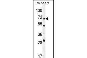 NT5C1B Antibody (N-term) (ABIN654258 and ABIN2844078) western blot analysis in mouse heart tissue lysates (35 μg/lane). (NT5C1B antibody  (N-Term))