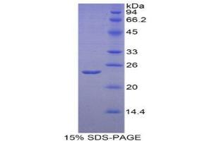 SDS-PAGE (SDS) image for Endothelial PAS Domain Protein 1 (EPAS1) (AA 339-541) protein (His tag) (ABIN2121275) (EPAS1 Protein (AA 339-541) (His tag))