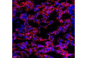 Immunofluorescence of paraffin embedded mouse lung using MAL2 (ABIN7074549) at dilution of 1: 650 (400x lens)