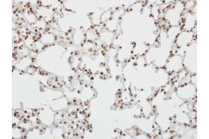 IHC-P Image Immunohistochemical analysis of paraffin-embedded human lung, using Pokemon, antibody at 1:100 dilution. (ZBTB7A antibody  (C-Term))
