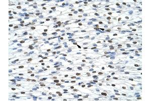 HNRPA0 antibody was used for immunohistochemistry at a concentration of 4-8 ug/ml to stain Myocardial cells (arrows) in Human Heart. (HNRNPA0 antibody  (Middle Region))