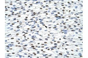 HNRPA0 antibody was used for immunohistochemistry at a concentration of 4-8 ug/ml to stain Myocardial cells (arrows) in Human Heart.
