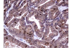 Image no. 1 for anti-Antigen Identified By Monoclonal Antibody Ki-67 (MKI67) (AA 2924-3256) antibody (ABIN1491345) (Ki-67 antibody  (AA 2924-3256))