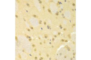 Immunohistochemistry of paraffin-embedded rat brain using SMAD1 antibody (ABIN5970455) at dilution of 1/100 (40x lens). (SMAD1 antibody)