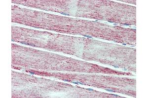 Anti-MNSOD / SOD2 antibody IHC staining of human skeletal muscle. (SOD2 antibody)