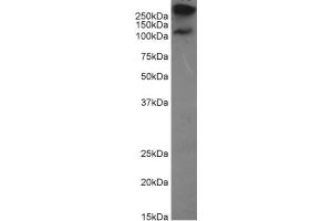 Western Blotting (WB) image for anti-Mucin 1 (MUC1) antibody (ABIN5668229)