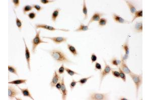 Immunohistochemistry (IHC) image for anti-Surfactant Protein D (SFTPD) (AA 292-321), (C-Term) antibody (ABIN3043335)