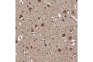 Immunohistochemical staining of human hippocampus with SEZ6 polyclonal antibody  shows cytoplasmic positivity in neurons at 1:20-1:50 dilution.