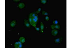 Immunofluorescent analysis of MCF-7 cells using ABIN7175671 at dilution of 1:100 and Alexa Fluor 488-congugated AffiniPure Goat Anti-Rabbit IgG(H+L) (WFDC2 antibody  (AA 31-124))