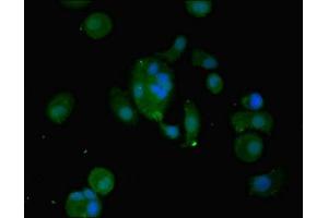 Immunofluorescent analysis of MCF-7 cells using ABIN7175671 at dilution of 1:100 and Alexa Fluor 488-congugated AffiniPure Goat Anti-Rabbit IgG(H+L) (WFDC2 antibody  (AA 31-124))
