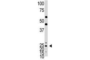 Image no. 1 for anti-Achaete-Scute Complex Homolog 1 (Drosophila) (ASCL1) (C-Term) antibody (ABIN357401) (ASCL1 antibody  (C-Term))