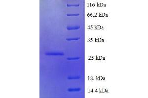 SDS-PAGE (SDS) image for S100 Calcium Binding Protein A6 (S100A6) (AA 1-90), (full length) protein (His-SUMO Tag) (ABIN5710298) (S100A6 Protein (AA 1-90, full length) (His-SUMO Tag))