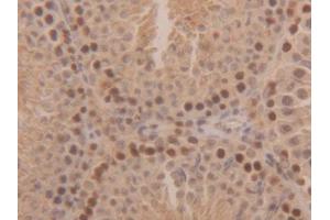 Used in DAB staining on fromalin fixed paraffin-embedded Kidney tissue (SOD1 antibody  (AA 2-154))