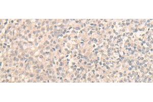 Immunohistochemistry of paraffin-embedded Human tonsil tissue using DDX59 Polyclonal Antibody at dilution of 1:30(x200) (DDX59 antibody)