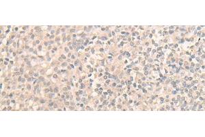 Immunohistochemistry of paraffin-embedded Human tonsil tissue using DDX59 Polyclonal Antibody at dilution of 1:30(x200) (DDX59 antibody)