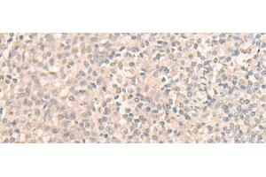 Immunohistochemistry of paraffin-embedded Human tonsil tissue using DDX59 Polyclonal Antibody at dilution of 1:30(x200)
