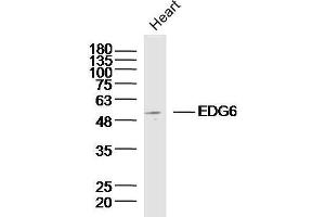 Mouse heart lysates probed with EDG6 Polyclonal Antibody, unconjugated  at 1:300 overnight at 4°C followed by a conjugated secondary antibody at 1:10000 for 90 minutes at 37°C. (S1PR4 antibody  (AA 301-384))