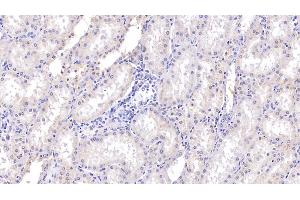 Detection of RNASE2 in Human Kidney Tissue using Polyclonal Antibody to Ribonuclease A2 (RNASE2) (RNASE2 antibody  (AA 28-161))